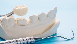 Debunked Myths About Dental Crowns Debunked Myths About Dental Crowns